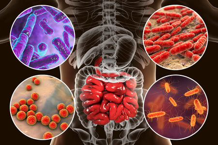 Přednáška - Význam transplantace stolice - změna termínu