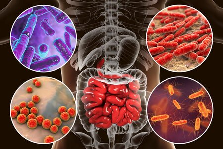 Přednáška - Mikrobiom a choroby trávicího traktu